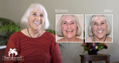  before and after of actual patient