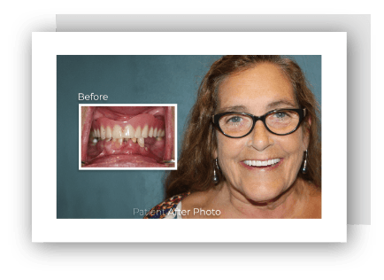 before and after photo