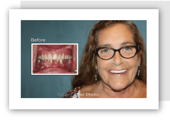 before and after photo