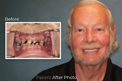 before and after photo