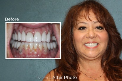 before and after photo