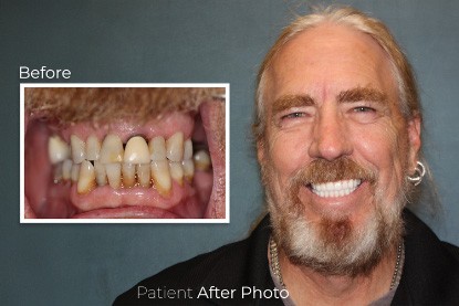 before and after photo