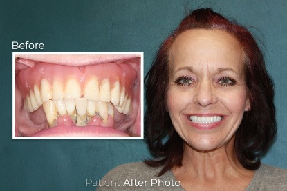 before and after photo