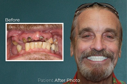 before and after photo