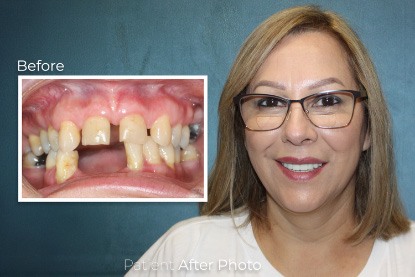 before and after photo